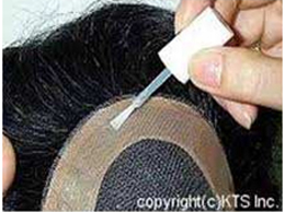 Hair-Bonding-camouflaging-tricks-face-value-hair-transplant-clinic-in mumbai-india-2